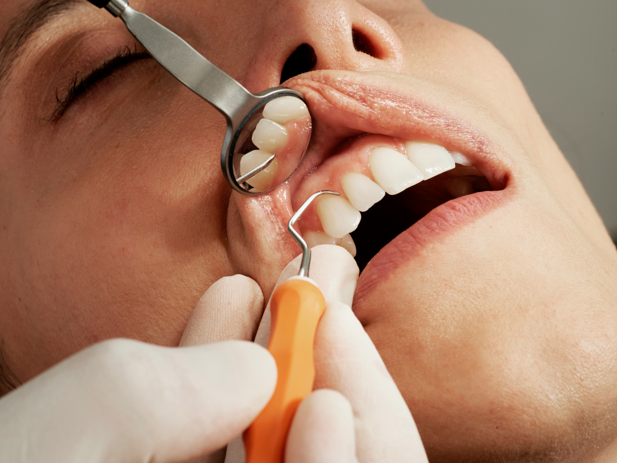 Essential Practices for Optimal Dental Treatment