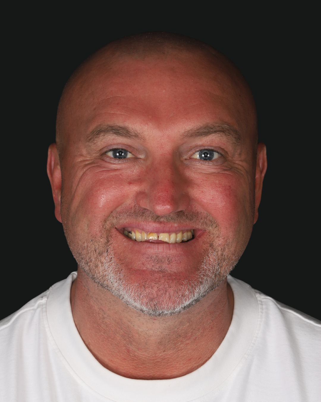 Black-and-White-Modern-Fashion-New-Collection-Instagram-Post-2