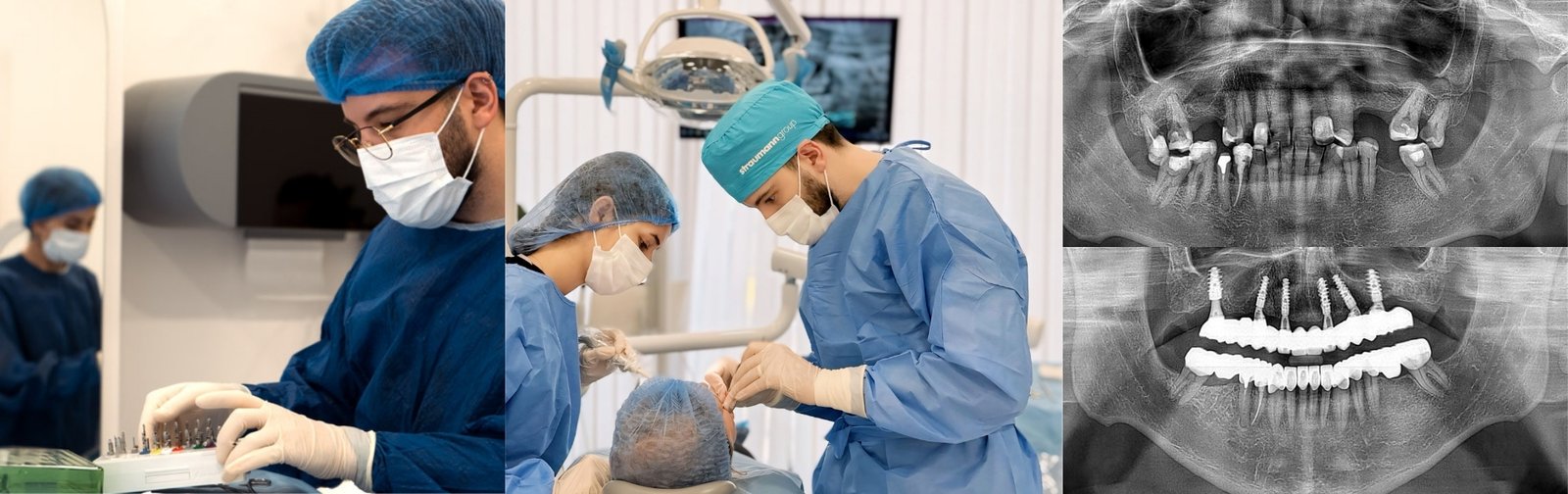 Dental Implants OD Clinic Alanya