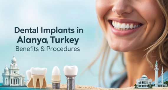 From Cost to Care: Dental Implants in Alanya, Turkey