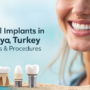 From Cost to Care: Dental Implants in Alanya, Turkey