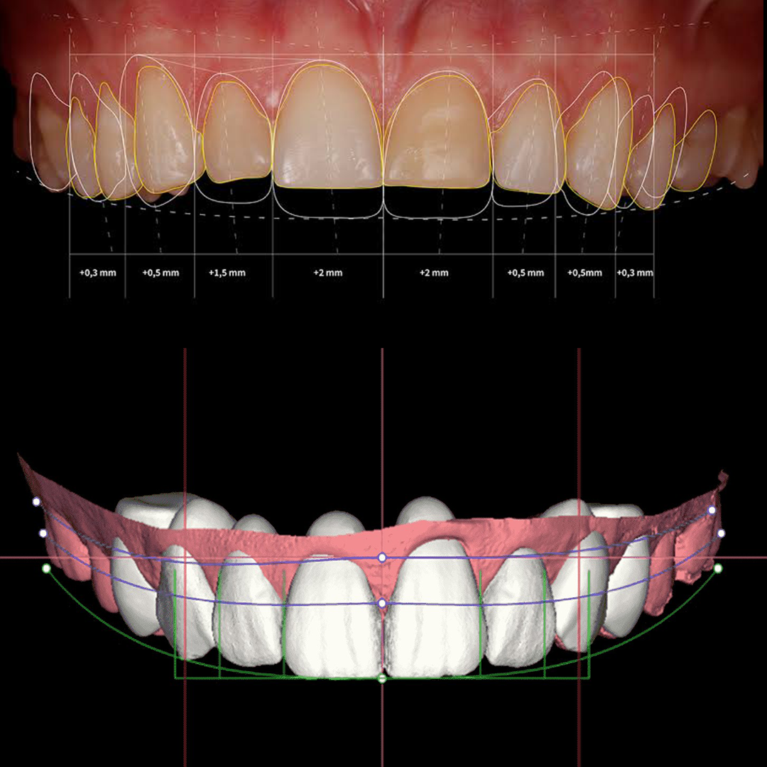 Digital Smile Design