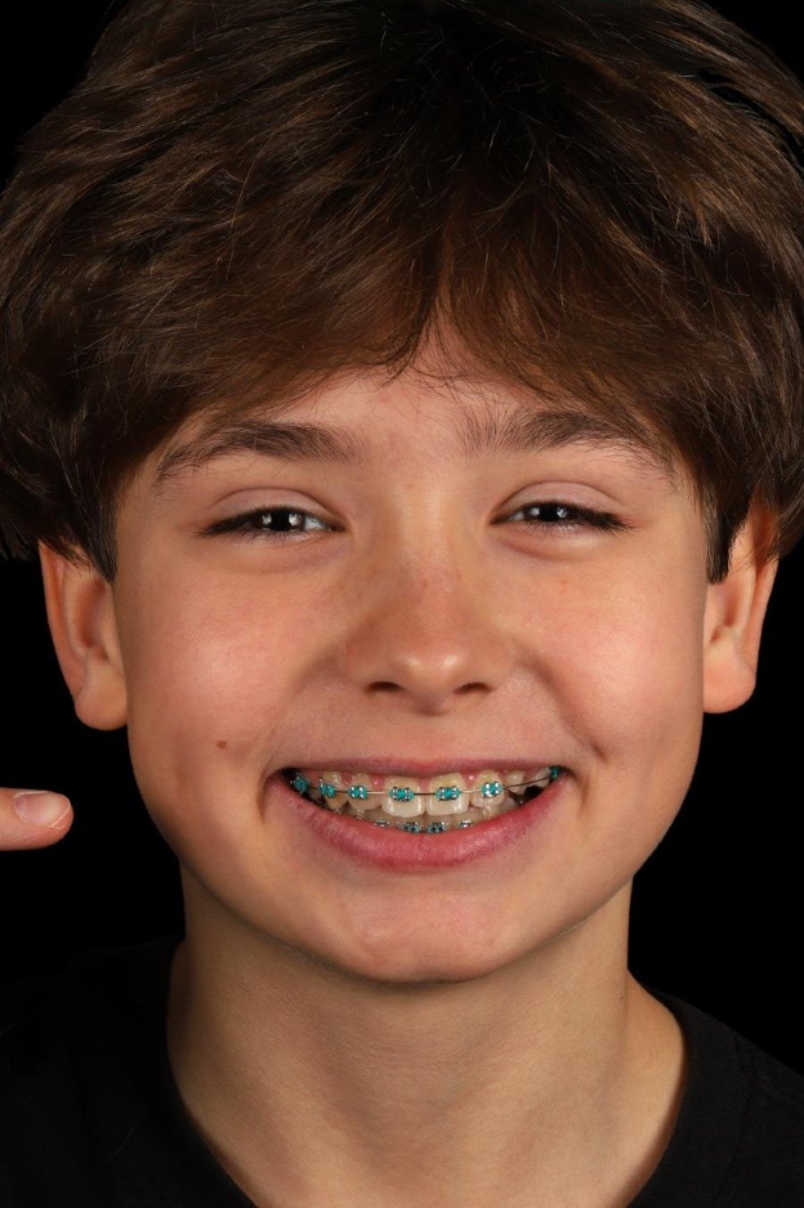 Smiling child at OD Clinic Alanya