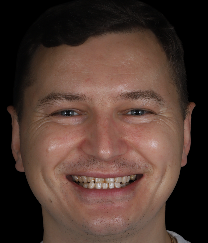 ağıziçi (23)