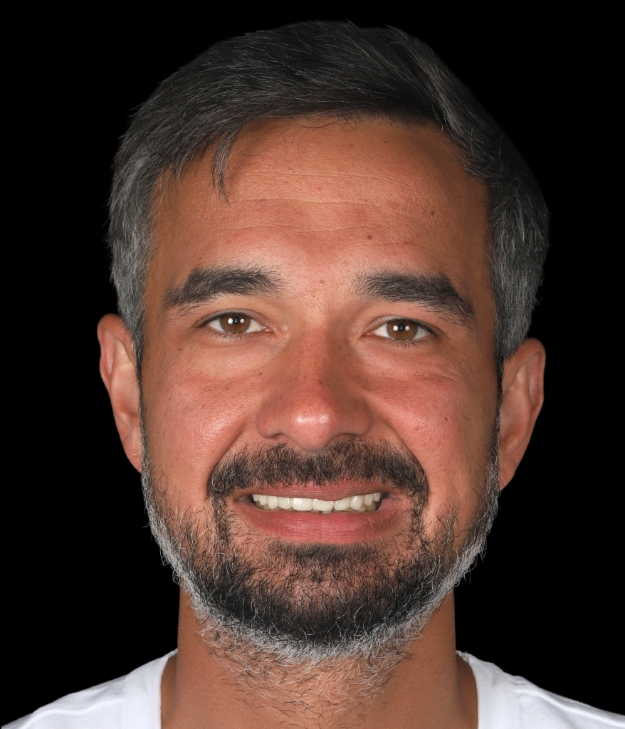 ağıziçi (5)