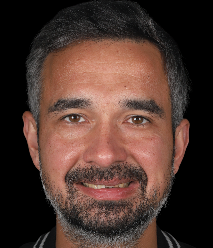 ağıziçi (6)