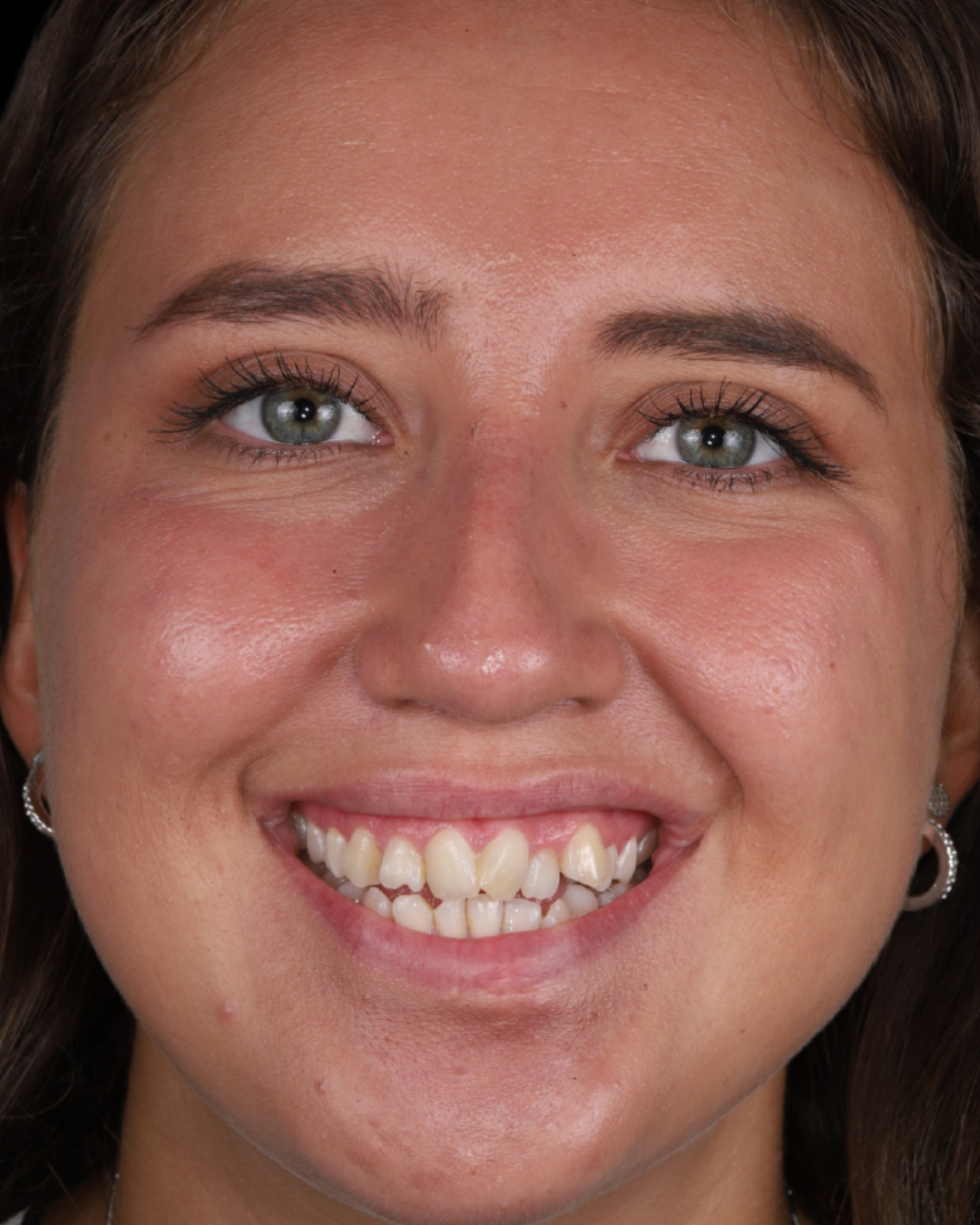 VALERIA (20)