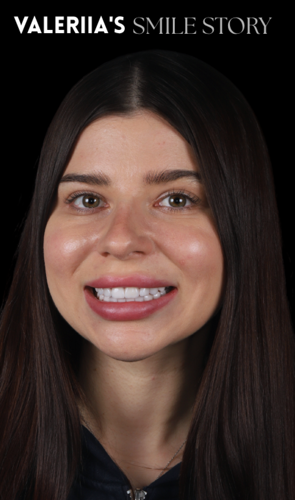 Aisulu's Smile Story (1)