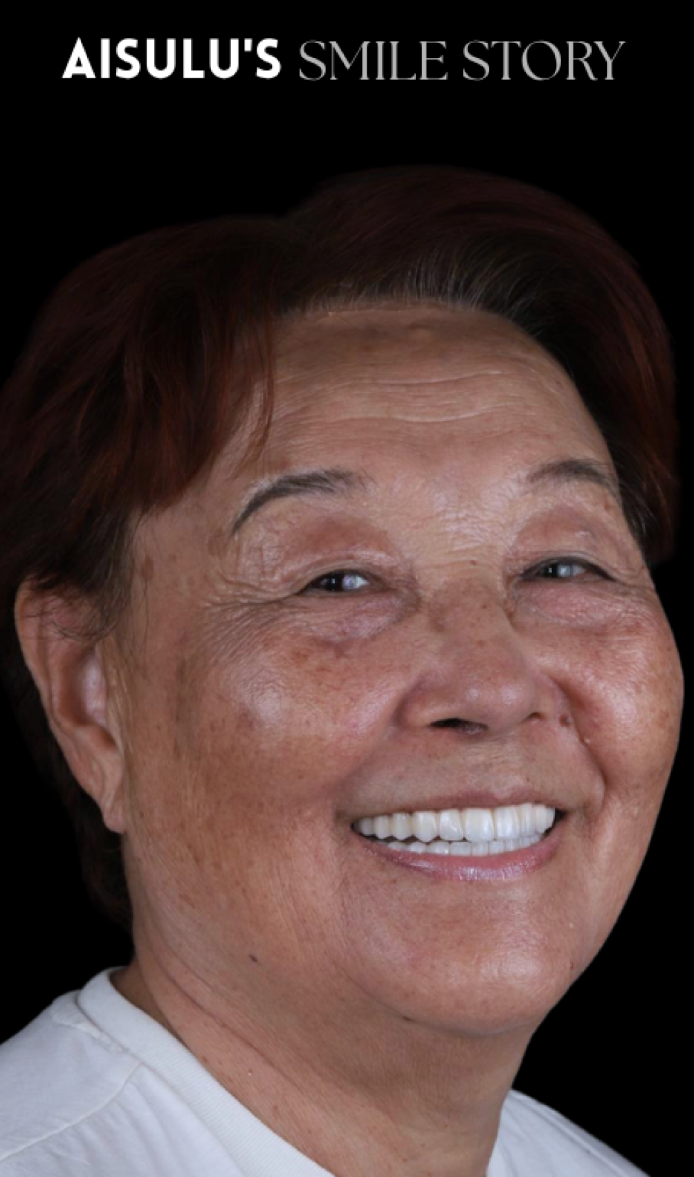 Aisulu's Smile Story
